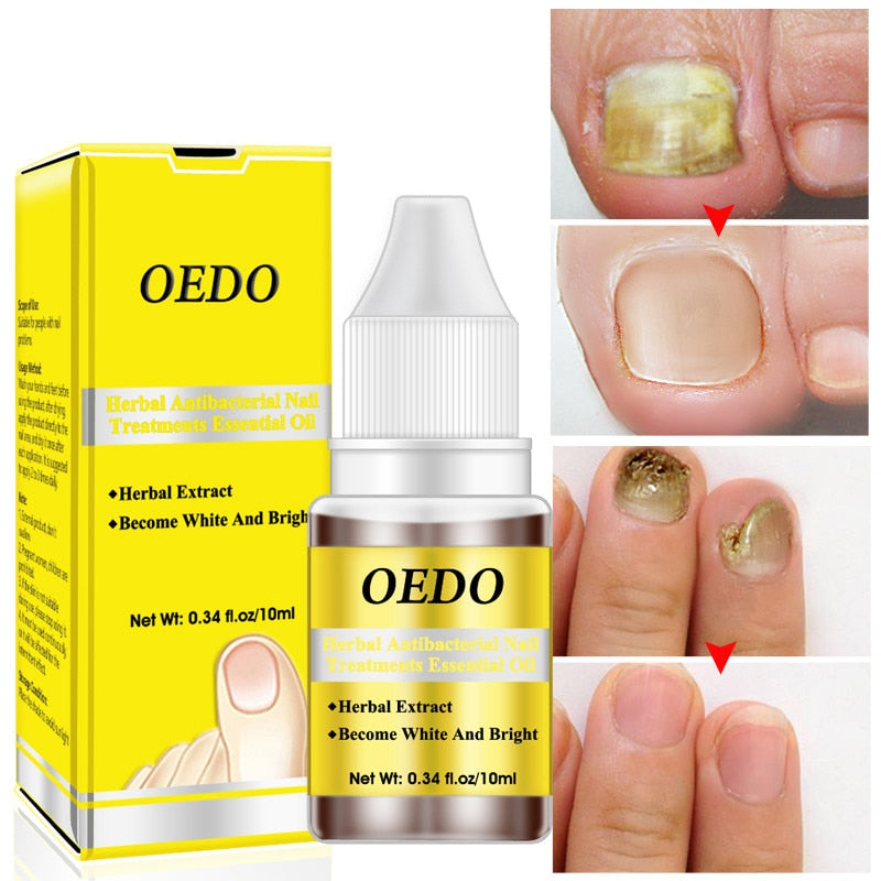 Herbal Nail Treatments Essential Oil