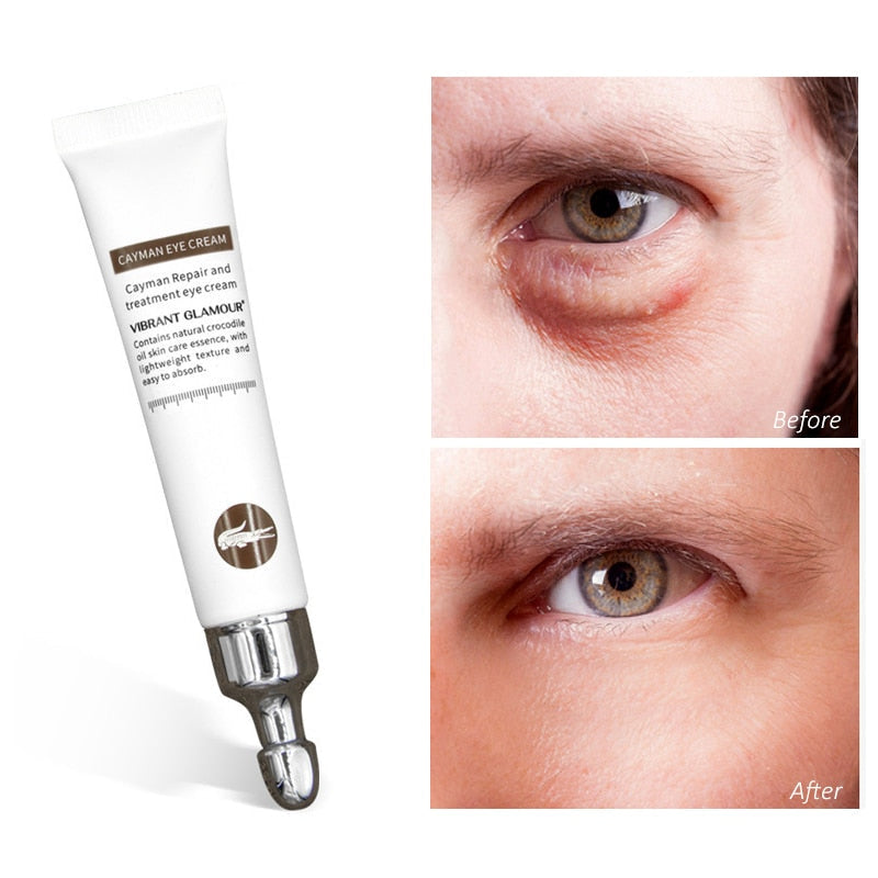 Magic Anti-Aging Eye Cream