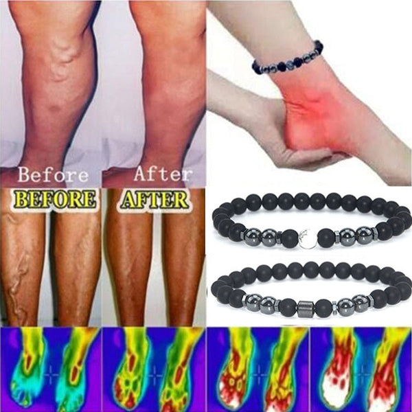 Anti Varicose And Swelling Magnetotherapy Anklet