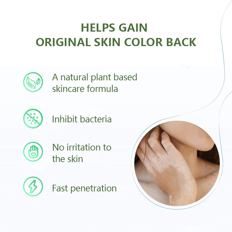 White Tag Treatment Moisturizing Cream