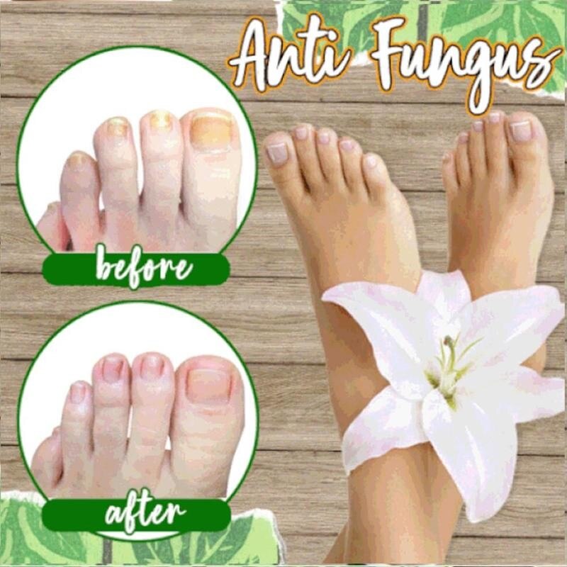 Anti-fungal Herbal Foot Soak